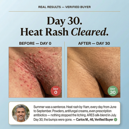 Boxers de Seda Premium | Conforto Todo o Dia